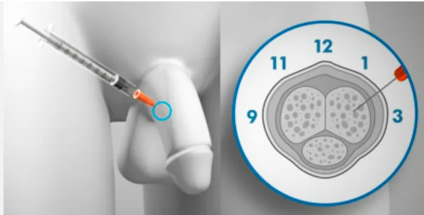 how to take bpc 157 orally bpc 157 oral dosing Peptide BPC 157